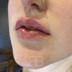 Abbi W 1
