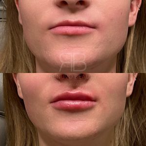 IMG_1925