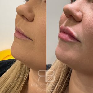 IMG_9022