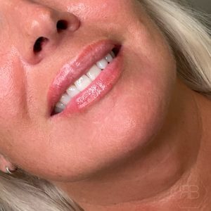 IMG_0843