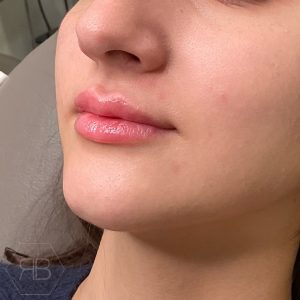 IMG_2137