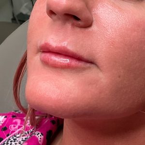 IMG_2147