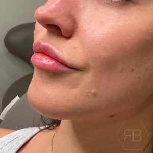 IMG_3259