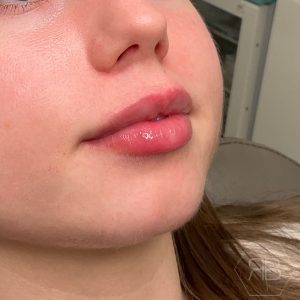 IMG_0839