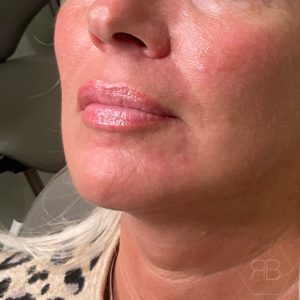 IMG_0845